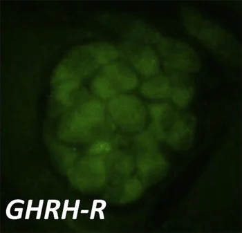 Immunocytochemistry/ Immunofluorescence - Anti-GHRHR antibody (AB76263)