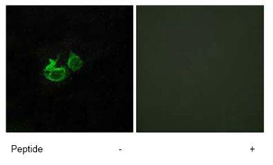 Immunocytochemistry/ Immunofluorescence - Anti-GHRHR antibody (AB76263)