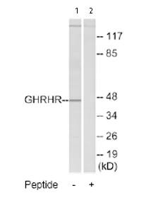 Western blot - Anti-GHRHR antibody (AB76263)