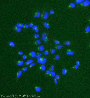 GLOTIN1994／イングリッシュホルンカマボコケーン15枚〜A〜AA GLOTIN1994／イングリッシュホルンカマボコケーン15枚〜A〜AA