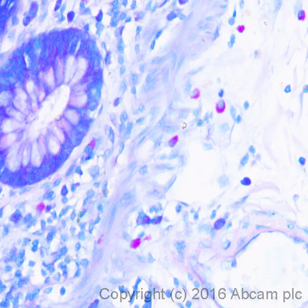 Histology - Giemsa Stain Kit (AB150670)