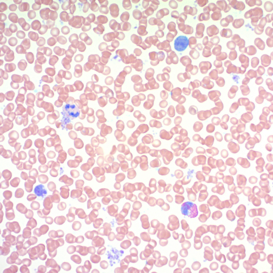 Histology - Giemsa Stain Kit (AB150670), expandable thumbnail