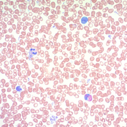 Histology - Giemsa Stain Kit (AB150670)