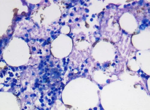 Histology - Giemsa Stain Kit (AB150670)