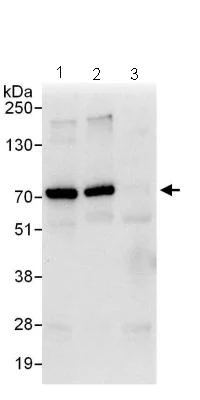 Immunoprecipitation - Anti-Gigaxonin antibody (AB101990)