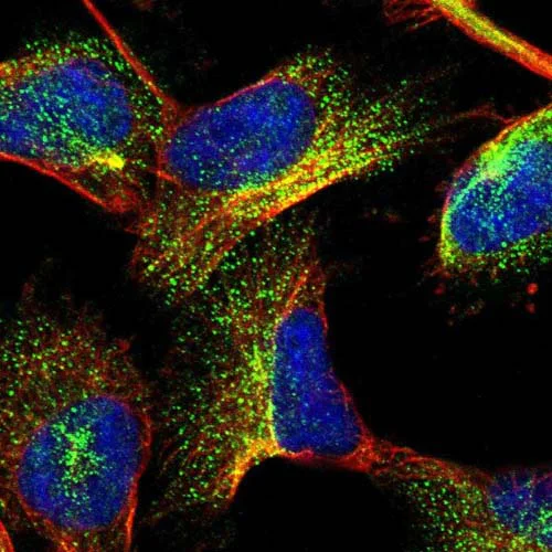 Immunocytochemistry/ Immunofluorescence - Anti-GIGYF1 antibody (AB121784)