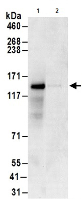 Immunoprecipitation - Anti-GIGYF1 antibody (AB177509)