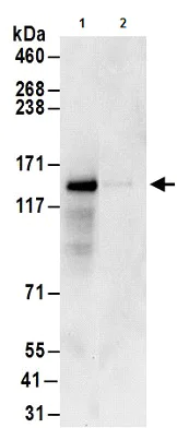 Immunoprecipitation - Anti-GIGYF1 antibody (AB177509)