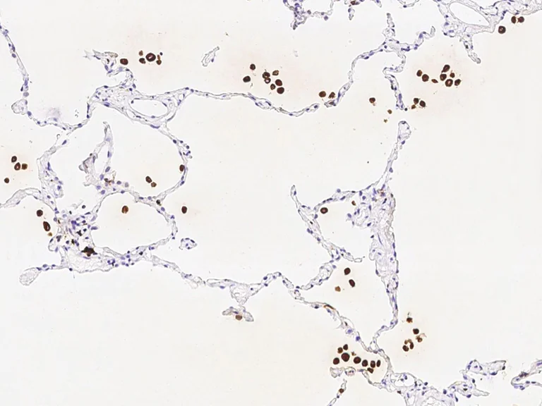 Immunohistochemistry (Formalin/PFA-fixed paraffin-embedded sections) - Anti-GILT antibody [003] - BSA and Azide free (AB276062)