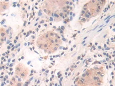 Immunohistochemistry (Formalin/PFA-fixed paraffin-embedded sections) - Anti-GILT antibody (AB232915)