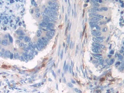 Immunohistochemistry (Formalin/PFA-fixed paraffin-embedded sections) - Anti-GILT antibody (AB232915)