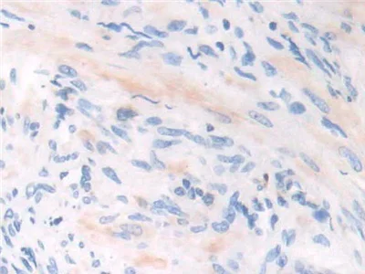 Immunohistochemistry (Formalin/PFA-fixed paraffin-embedded sections) - Anti-GILT antibody (AB232915)