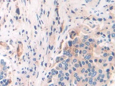 Immunohistochemistry (Formalin/PFA-fixed paraffin-embedded sections) - Anti-GILT antibody (AB232915)
