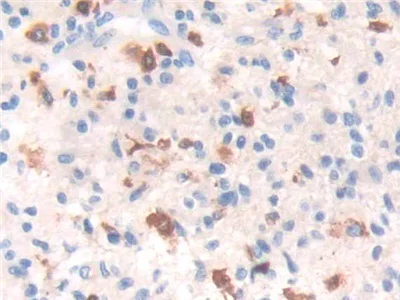 Immunohistochemistry (Formalin/PFA-fixed paraffin-embedded sections) - Anti-GILT antibody (AB232915)