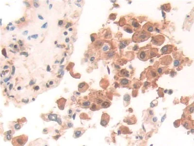 Immunohistochemistry (Formalin/PFA-fixed paraffin-embedded sections) - Anti-GILT antibody (AB232915)
