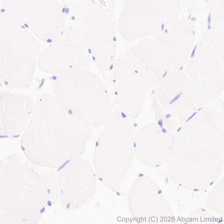 Immunohistochemistry (Formalin/PFA-fixed paraffin-embedded sections) - Anti-GILT antibody [EPR30714-572] (AB325920)