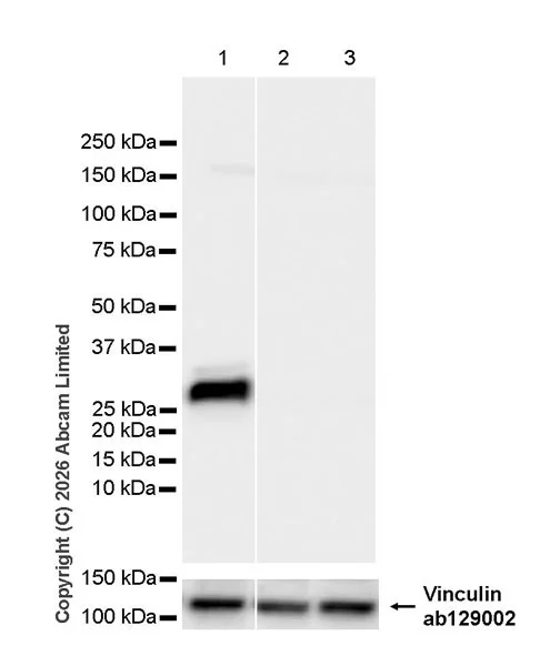 Western blot - Anti-GILT antibody [EPR30714-572] (AB325920)