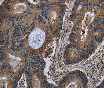 Immunohistochemistry (Formalin/PFA-fixed paraffin-embedded sections) - Anti-GilZ / TilZ antibody (AB197987)