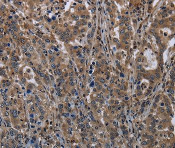 Immunohistochemistry (Formalin/PFA-fixed paraffin-embedded sections) - Anti-GilZ / TilZ antibody (AB197987)