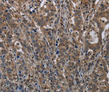 Immunohistochemistry (Formalin/PFA-fixed paraffin-embedded sections) - Anti-GilZ / TilZ antibody (AB197987)