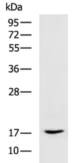 Western blot - Anti-GilZ / TilZ antibody (AB197987)