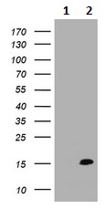 Western blot - Anti-GilZ / TilZ antibody [OTI1F11] (AB236524)