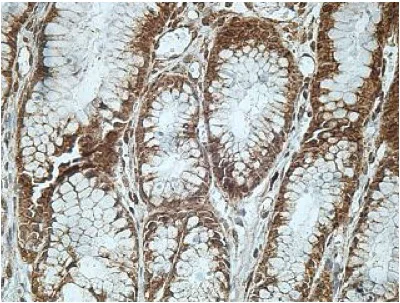 Immunohistochemistry (Formalin/PFA-fixed paraffin-embedded sections) - Anti-GINS2 antibody (AB197123)