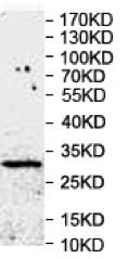Western blot - Anti-GINS2 antibody (AB197123)