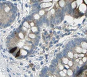 Immunohistochemistry (Formalin/PFA-fixed paraffin-embedded sections) - Anti-GIP antibody [04] (AB30679)
