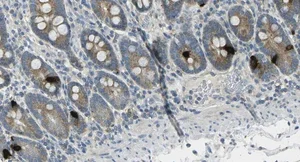 Immunohistochemistry (Formalin/PFA-fixed paraffin-embedded sections) - Anti-GIP antibody [04] (AB30679)