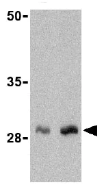Western blot - Anti-GIP antibody (AB25973)