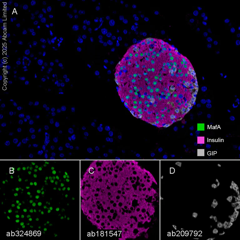Multiplex immunohistochemistry - Anti-GIP antibody [EPR20410] (AB209792)