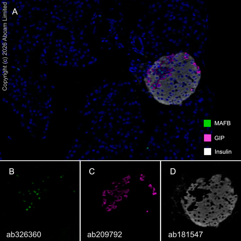 Multiplex immunohistochemistry - Anti-GIP antibody [EPR20410] (AB209792)