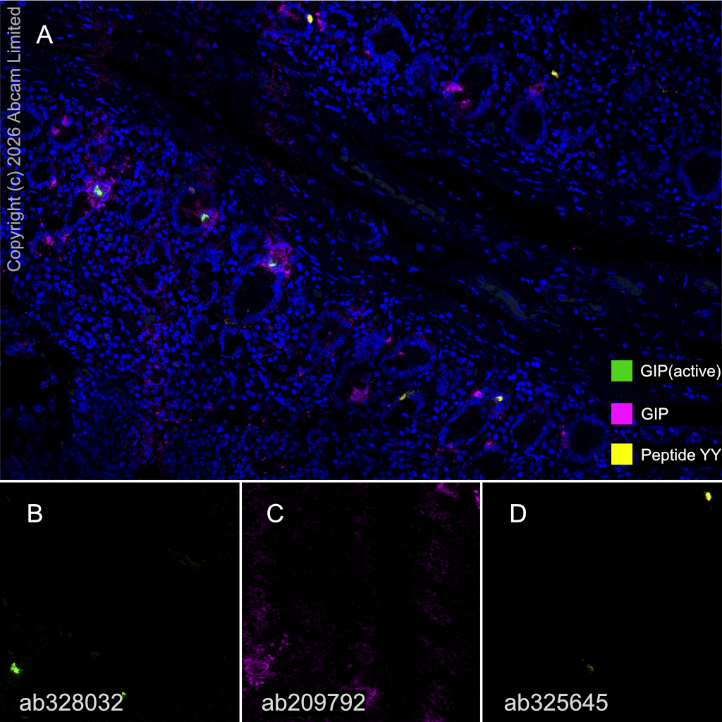 Multiplex immunohistochemistry - Anti-GIP antibody [EPR20410] (AB209792)