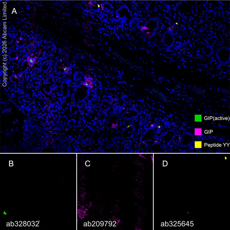 Multiplex immunohistochemistry - Anti-GIP antibody [EPR20410] (AB209792)