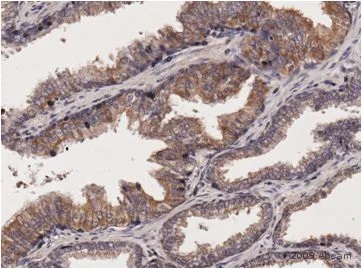 Immunohistochemistry (Formalin/PFA-fixed paraffin-embedded sections) - Anti-GIPC1 antibody (AB5951)