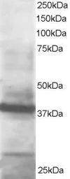 Western blot - Anti-GIPC1 antibody (AB5951)