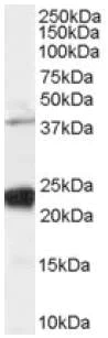Western blot - Anti-GIPC1 antibody (AB5951)