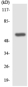 Western blot - Anti-GIPR antibody (AB136266)