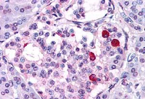 Immunohistochemistry (Formalin/PFA-fixed paraffin-embedded sections) - Anti-GIPR antibody - N-terminal (AB188591)