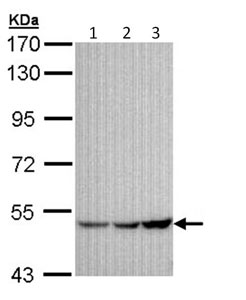 Western blot - Anti-GIRK1 antibody (AB96168), expandable thumbnail