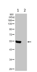 Western blot - Anti-GIRK1 antibody (AB96168)