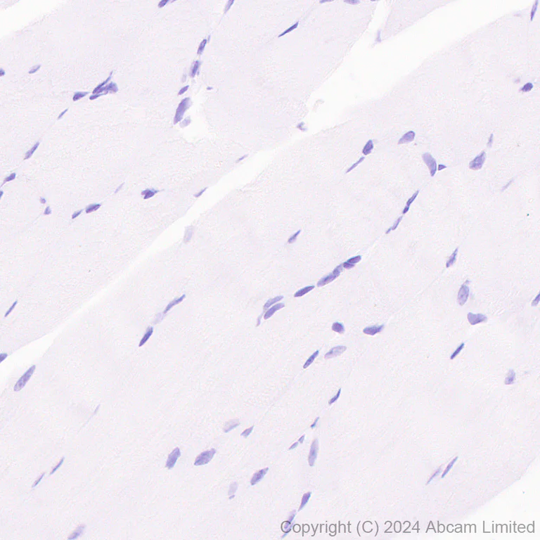 Immunohistochemistry (Formalin/PFA-fixed paraffin-embedded sections) - Anti-GIRK1 antibody [EPR29281-68] (AB320743)