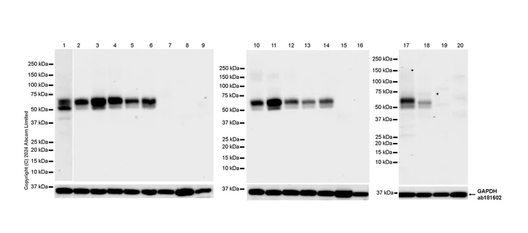 Western blot - Anti-GIRK1 antibody [EPR29281-68] (AB320743)