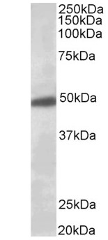 Western blot - Anti-GIRK2 antibody (AB65096), expandable thumbnail