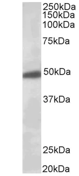 Western blot - Anti-GIRK2 antibody (AB65096)