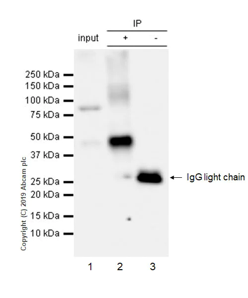 Immunoprecipitation - Anti-GIRK2 antibody [EPR22347-2] - BSA and Azide free (AB256311)