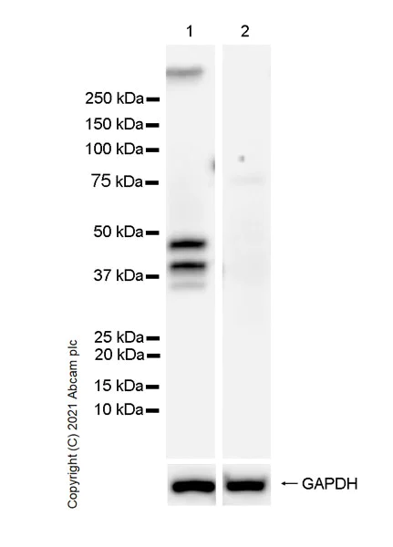 Western blot - Anti-GIRK2 antibody [EPR23841-83] (AB259909)