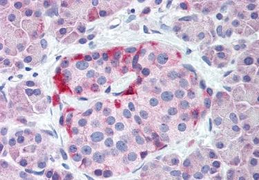 Immunohistochemistry (Formalin/PFA-fixed paraffin-embedded sections) - Anti-GIRK2 antibody - N-terminal (AB219190), expandable thumbnail