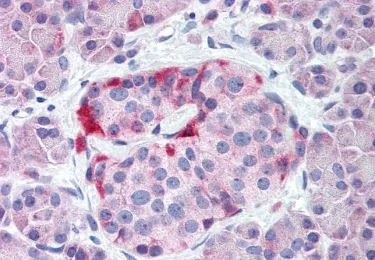 Immunohistochemistry (Formalin/PFA-fixed paraffin-embedded sections) - Anti-GIRK2 antibody - N-terminal (AB219190)